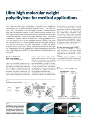  Ultra-High Molecular Weight Polyethylene: La Star des Applications Tribologiques Extrêmes !